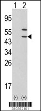 Western blot analysis of his-tag PDK2 (arrow) using his tag antibody. 293 cell lysates (2 ug/lane) either nontransfected (Lane 1) or transiently transfected with the PDK2 gene (Lane 2, Cat. #LY10352a).
