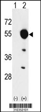 Western blot analysis of his-tag BLK (arrow) using his tag antibody. 293 cell lysates (2 ug/lane) either nontransfected (Lane 1) or transiently transfected with the BLK gene