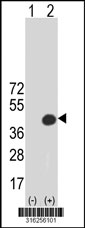 Western blot analysis of his-tag RHBDD3 (arrow) using his tag antibody. 293T cell lysates (2 ug/lane) either nontransfected (Lane 1) or transiently transfected with the RHBDD3 gene‘
