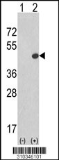 Western blot analysis of his-tag TRIB2 (arrow) using his tag antibody. 293 cell lysates (2 ug/lane) either nontransfected (Lane 1) or transiently transfected with the TRIB2 gene (Lane 2, Cat. #LY10346a).