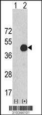 Western blot analysis of his-tag MKNK1 (arrow) using his tag antibody. 293 cell lysates (2 ug/lane) either nontransfected (Lane 1) or transiently transfected with the MKNK1 gene (Lane 2, Cat. #LY10344a).