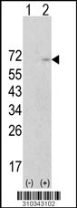 Western blot analysis of his-tag PFKFB3 (arrow) using his tag antibody. 293 cell lysates (2 ug/lane) either nontransfected (Lane 1) or transiently transfected with the PFKFB3 gene (Lane 2, Cat. #LY10343a).