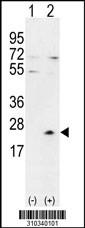 Western blot analysis of his-tag TXNDC6 (arrow) using his tag antibody. 293 cell lysates (2 ug/lane) either nontransfected (Lane 1) or transiently transfected with the TXNDC6 gene