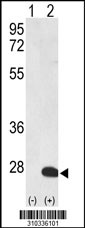 Western blot analysis of his-tag OBSCN (arrow) using his tag antibody. 293 cell lysates (2 ug/lane) either nontransfected (Lane 1) or transiently transfected with the OBSCN gene