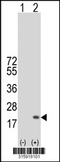 Western blot analysis of his-tag POFUT2 (arrow) using his tag antibody. 293T cell lysates (2 ug/lane) either nontransfected (Lane 1) or transiently transfected with the POFUT2 gene‘