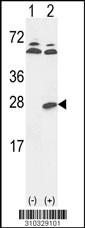 Western blot analysis of his-tag PRL (arrow) using his tag antibody. 293 cell lysates (2 ug/lane) either nontransfected (Lane 1) or transiently transfected with the PRL gene (Lane 2, Cat. #LY10329a).