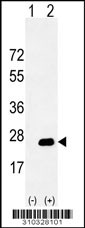 Western blot analysis of his-tag BTC (arrow) using his tag antibody. 293 cell lysates (2 ug/lane) either nontransfected (Lane 1) or transiently transfected with the BTC gene