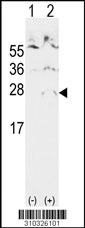 Western blot analysis of his-tag BRSK2 (arrow) using his tag antibody. 293 cell lysates (2 ug/lane) either nontransfected (Lane 1) or transiently transfected with the BRSK2 gene (Lane 2, Cat. #LY10326a).