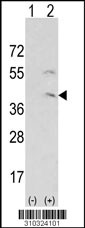 Western blot analysis of his-tag PRKG1 (arrow) using his tag antibody. 293 cell lysates (2 ug/lane) either nontransfected (Lane 1) or transiently transfected with the PRKG1 gene (Lane 2, Cat. #LY10324a).