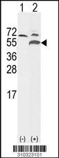 Western blot analysis of his-tag CHKB (arrow) using his tag antibody. 293 cell lysates (2 ug/lane) either nontransfected (Lane 1) or transiently transfected with the CHKB gene (Lane 2, Cat. #LY10323a).