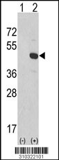 Western blot analysis of his-tag CDC73 (arrow) using his tag antibody. 293 cell lysates (2 ug/lane) either nontransfected (Lane 1) or transiently transfected with the CDC73 gene (Lane 2, Cat. #LY10322a).