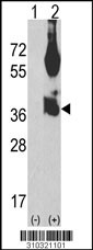 Western blot analysis of his-tag CDCP1 (arrow) using his tag antibody. 293 cell lysates (2 ug/lane) either nontransfected (Lane 1) or transiently transfected with the CDCP1 gene (Lane 2, Cat. #LY10321a).