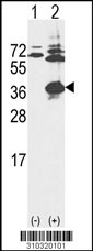 Western blot analysis of his-tag RBKS (arrow) using his tag antibody. 293 cell lysates (2 ug/lane) either nontransfected (Lane 1) or transiently transfected with the RBKS gene (Lane 2, Cat. #LY10320a).