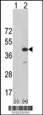 Western blot analysis of his-tag IRAK4 (arrow) using his tag antibody. 293 cell lysates (2 ug/lane) either nontransfected (Lane 1) or transiently transfected with the IRAK4 gene (Lane 2, Cat. #LY10318a).