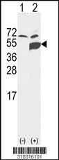 Western blot analysis of his-tag MAP2K2 (arrow) using his tag antibody. 293 cell lysates (2 ug/lane) either nontransfected (Lane 1) or transiently transfected with the MAP2K2 gene (Lane 2, Cat. #LY10316a).