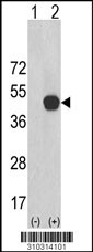 Western blot analysis of his-tag PIP5K1A (arrow) using his tag antibody. 293 cell lysates (2 ug/lane) either nontransfected (Lane 1) or transiently transfected with the PIP5K1A gene (Lane 2, Cat. #LY10314a).