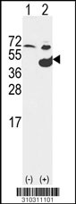 Western blot analysis of his-tag GALK1 (arrow) using his tag antibody. 293 cell lysates (2 ug/lane) either nontransfected (Lane 1) or transiently transfected with the GALK1 gene (Lane 2, Cat. #LY10311a).