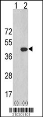 Western blot analysis of his-tag CHEK1 (arrow) using his tag antibody. 293 cell lysates (2 ug/lane) either nontransfected (Lane 1) or transiently transfected with the CHEK1 gene (Lane 2, Cat. #LY10309a).