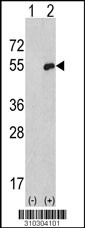 Western blot analysis of his-tag GAP43 (arrow) using his tag antibody. 293 cell lysates (2 ug/lane) either nontransfected (Lane 1) or transiently transfected with the GAP43 gene (Lane 2, Cat. #LY10304a).
