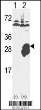 Western blot analysis of his-tag COMT (arrow) using his tag antibody. 293 cell lysates (2 ug/lane) either nontransfected (Lane 1) or transiently transfected with the COMT gene (Lane 2, Cat. #LY10302a).