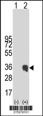 Western blot analysis of his-tag C21orf45 (arrow) using his tag antibody. 293T cell lysates (2 ug/lane) either nontransfected (Lane 1) or transiently transfected with the C21orf45 gene‘
