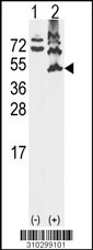 Western blot analysis of his-tag ACTA2 (arrow) using his tag antibody. 293 cell lysates (2 ug/lane) either nontransfected (Lane 1) or transiently transfected with the ACTA2 gene (Lane 2, Cat. #LY10299a).