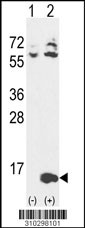 Western blot analysis of his-tag CCL3 (arrow) using his tag antibody. 293 cell lysates (2 ug/lane) either nontransfected (Lane 1) or transiently transfected with the CCL3 gene (Lane 2, Cat. #LY10298a).