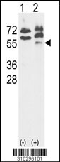 Western blot analysis of his-tag DYRK2 (arrow) using his tag antibody. 293 cell lysates (2 ug/lane) either nontransfected (Lane 1) or transiently transfected with the DYRK2 gene (Lane 2, Cat. #LY10296a).