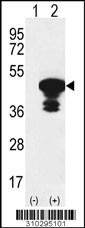 Western blot analysis of his-tag PHKG1 (arrow) using his tag antibody. 293 cell lysates (2 ug/lane) either nontransfected (Lane 1) or transiently transfected with the PHKG1 gene