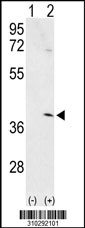 Western blot analysis of his-tag AURKC (arrow) using his tag antibody. 293 cell lysates (2 ug/lane) either nontransfected (Lane 1) or transiently transfected with the AURKC gene