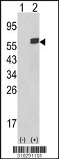 Western blot analysis of his-tag PKM2 (arrow) using his tag antibody. 293 cell lysates (2 ug/lane) either nontransfected (Lane 1) or transiently transfected with the PKM2 gene (Lane 2, Cat. #LY10291a).