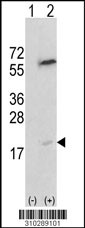 Western blot analysis of his-tag PPP3R2 (arrow) using his tag antibody. 293 cell lysates (2 ug/lane) either nontransfected (Lane 1) or transiently transfected with the PPP3R2 gene (Lane 2, Cat. #LY10289a).
