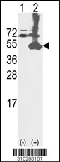 Western blot analysis of his-tag PON1 (arrow) using his tag antibody. 293 cell lysates (2 ug/lane) either nontransfected (Lane 1) or transiently transfected with the PON1 gene (Lane 2, Cat. #LY10288a).