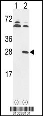 Western blot analysis of his-tag NDUFV2 (arrow) using his tag antibody. 293 cell lysates (2 ug/lane) either nontransfected (Lane 1) or transiently transfected with the NDUFV2 gene (Lane 2, Cat. #LY10283a).