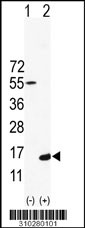 Western blot analysis of his-tag NDUFA3 (arrow) using his tag antibody. 293 cell lysates (2 ug/lane) either nontransfected (Lane 1) or transiently transfected with the NDUFA3 gene