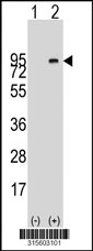 Western blot analysis of his-tag SCNN1B (arrow) using his tag antibody. 293T cell lysates (2 ug/lane) either nontransfected (Lane 1) or transiently transfected with the SCNN1B gene‘