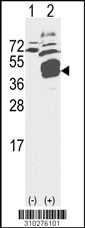 Western blot analysis of his-tag FCER2 (arrow) using his tag antibody. 293 cell lysates (2 ug/lane) either nontransfected (Lane 1) or transiently transfected with the FCER2 gene (Lane 2, Cat. #LY10276a).