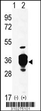 Western blot analysis of his-tag ECHS1 (arrow) using his tag antibody. 293 cell lysates (2 ug/lane) either nontransfected (Lane 1) or transiently transfected with the ECHS1 gene