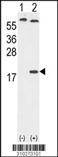 Western blot analysis of his-tag DAP (arrow) using his tag antibody. 293 cell lysates (2 ug/lane) either nontransfected (Lane 1) or transiently transfected with the DAP gene (Lane 2, Cat. #LY10273a).