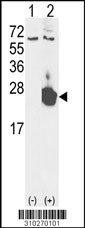 Western blot analysis of his-tag CDC42 (arrow) using his tag antibody. 293 cell lysates (2 ug/lane) either nontransfected (Lane 1) or transiently transfected with the CDC42 gene (Lane 2, Cat. #LY10270a).