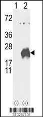 Western blot analysis of his-tag CD3D (arrow) using his tag antibody. 293 cell lysates (2 ug/lane) either nontransfected (Lane 1) or transiently transfected with the CD3D gene (Lane 2, Cat. #LY10267a).