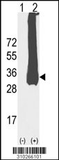 Western blot analysis of his-tag C1QB (arrow) using his tag antibody. 293 cell lysates (2 ug/lane) either nontransfected (Lane 1) or transiently transfected with the C1QB gene (Lane 2, Cat. #LY10266a).