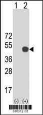 Western blot analysis of his-tag DSN1 (arrow) using his tag antibody. 293T cell lysates (2 ug/lane) either nontransfected (Lane 1) or transiently transfected with the DSN1 gene‘