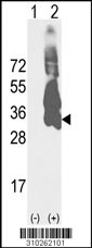 Western blot analysis of his-tag MBL2 (arrow) using his tag antibody. 293 cell lysates (2 ug/lane) either nontransfected (Lane 1) or transiently transfected with the MBL2 gene (Lane 2, Cat. #LY10262a).