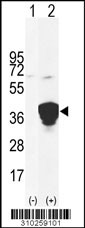 Western blot analysis of his-tag KLRC1 (arrow) using his tag antibody. 293 cell lysates (2 ug/lane) either nontransfected (Lane 1) or transiently transfected with the KLRC1 gene