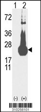 Western blot analysis of his-tag ITPA (arrow) using his tag antibody. 293 cell lysates (2 ug/lane) either nontransfected (Lane 1) or transiently transfected with the ITPA gene (Lane 2, Cat. #LY10258a).