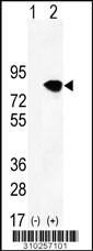 Western blot analysis of his-tag IFNGR2 (arrow) using his tag antibody. 293 cell lysates (2 ug/lane) either nontransfected (Lane 1) or transiently transfected with the IFNGR2 gene