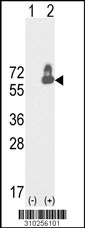 Western blot analysis of his-tag HP (arrow) using his tag antibody. 293 cell lysates (2 ug/lane) either nontransfected (Lane 1) or transiently transfected with the HP gene (Lane 2, Cat. #LY10256a).