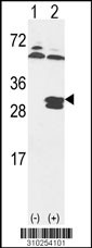 Western blot analysis of his-tag HLA-DRB5 (arrow) using his tag antibody. 293 cell lysates (2 ug/lane) either nontransfected (Lane 1) or transiently transfected with the HLA-DRB5 gene (Lane 2, Cat. #LY10254a).