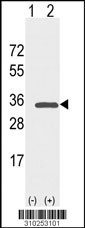 Western blot analysis of his-tag HLA-DRB3 (arrow) using his tag antibody. 293 cell lysates (2 ug/lane) either nontransfected (Lane 1) or transiently transfected with the HLA-DRB3 gene (Lane 2, Cat. #LY10253a).